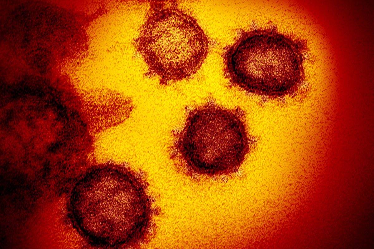 FILE - This undated electron microscope image made available by the U.S. National Institutes of Health in February 2020 shows the Novel Coronavirus SARS-CoV-2. Also known as 2019-nCoV, the virus causes COVID-19. The sample was isolated from a patient in the U.S. (NIAID-RML via AP)