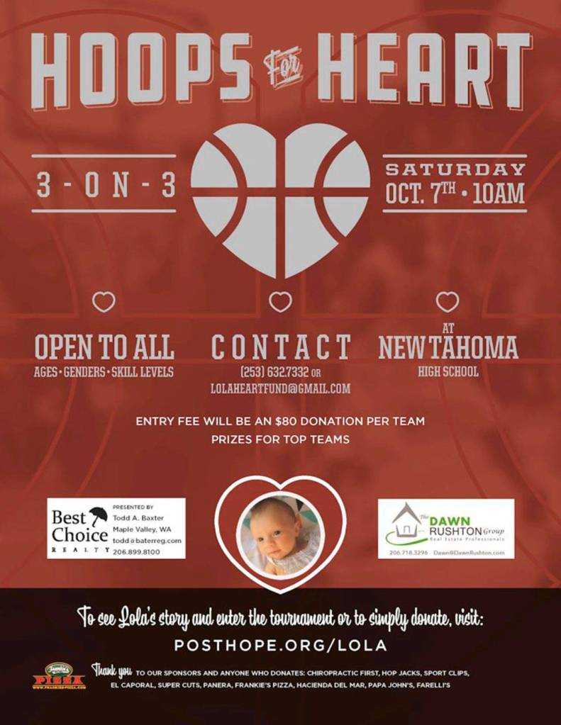 Maple Valley baby born with rare pulmonary artery defect