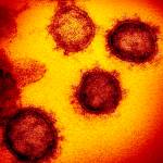 FILE - This undated electron microscope image made available by the U.S. National Institutes of Health in February 2020 shows the Novel Coronavirus SARS-CoV-2. Also known as 2019-nCoV, the virus causes COVID-19. The sample was isolated from a patient in the U.S. (NIAID-RML via AP)