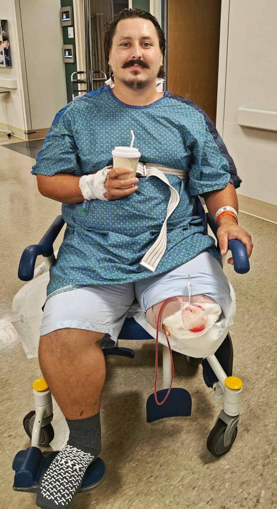 Steven Polson had his left leg amputated after being injured July 15 in a Kent crash while riding his motorcycle, which was hit by an alleged DUI driver. COURTESY PHOTO, GoFundMe